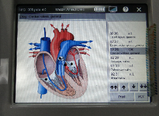 画像(326x238)