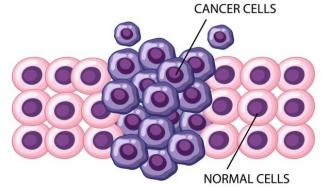 画像(330x191)・拡大画像(640x372)